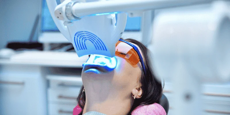 maintenance-and-teeth-whitening-options