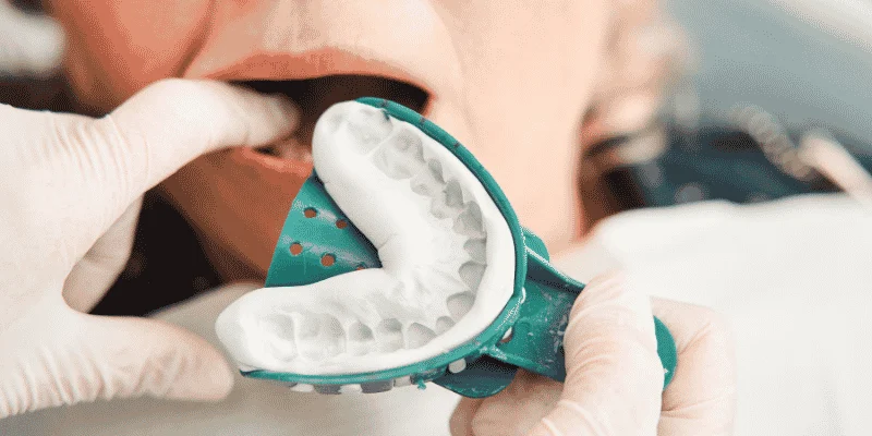 recovery-aftercare-and-implant-restoration