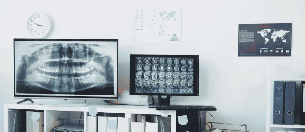Dental X-ray displayed on office monitors