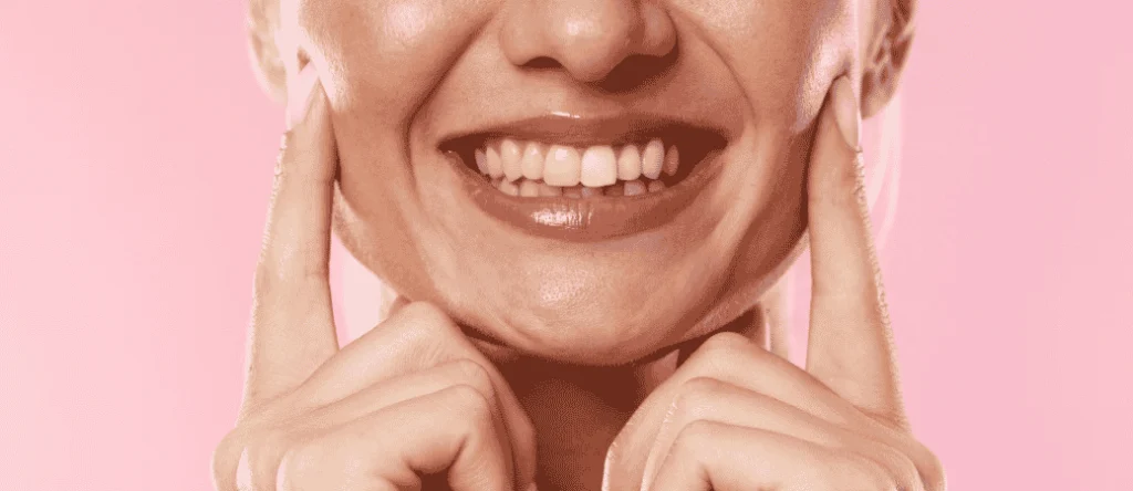 Smiling woman pointing to her bright teeth