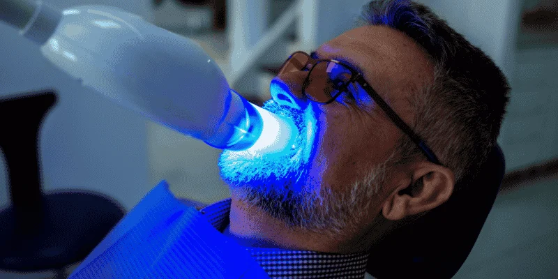professional-teeth-whitening-benefits-why-expert-whitening-is-worth-it